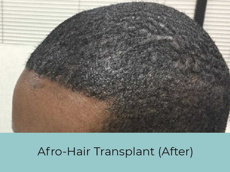 afro-before