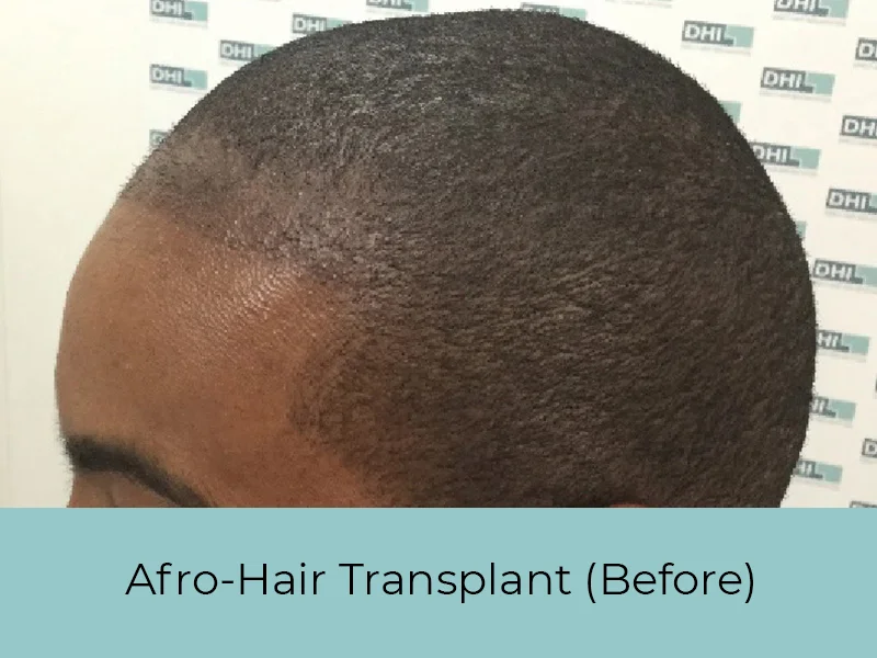 afro-before
