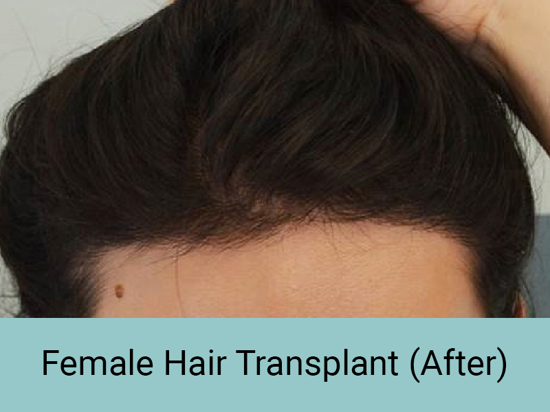 female-hair-after