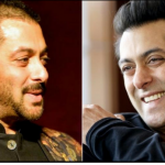 salman-khan-hair-transplant