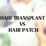 Hair transplant versus cosmetic hair patches