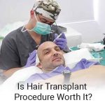Is hair transplant procedure worth it?