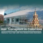 Hair Transplant in Colombia