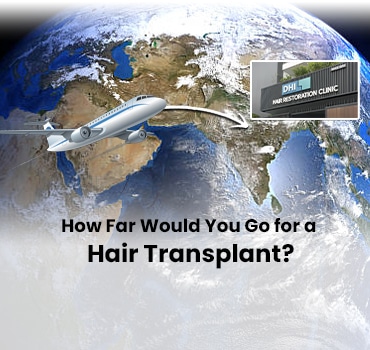 How Far Would You Go for a Hair Transplant?