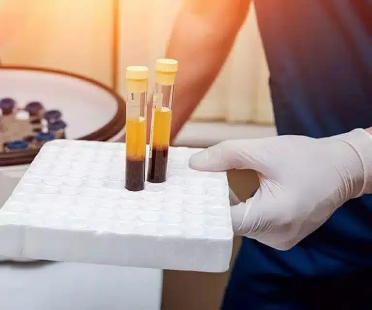 prp-hair-treatment PRP HAIR TREATMENT