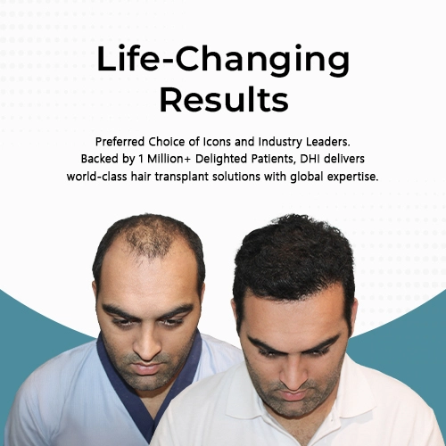 Hair Transplant Result Mobile